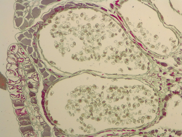 Male Cone CS Slides - Male Cone CS 01 100X